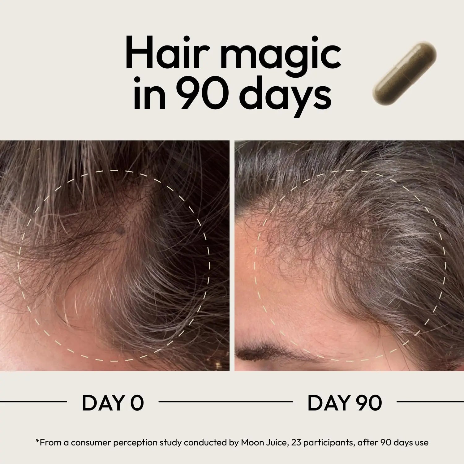 Moon Juice SuperHair Hair Growth Vitamins for Women & Men with Biotin & Saw Palmetto - Clinical Strength Multivitamin Hair Supplement Moon Juice