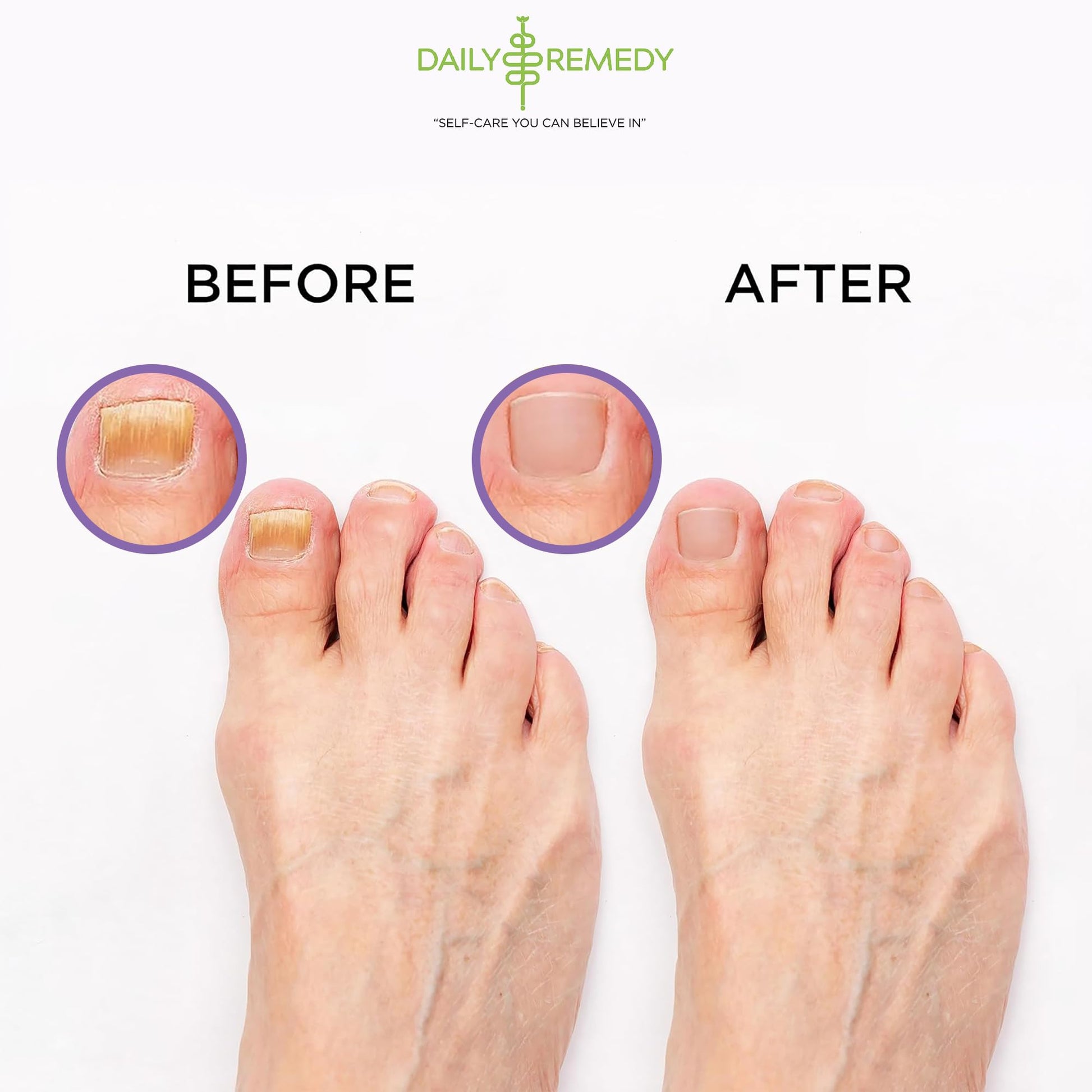 Calming Lavender Foot Soak with Epsom Salt, Made in USA, Foot Soak Soothes Sore Tired DAILY REMEDYBuy Supplements Australia