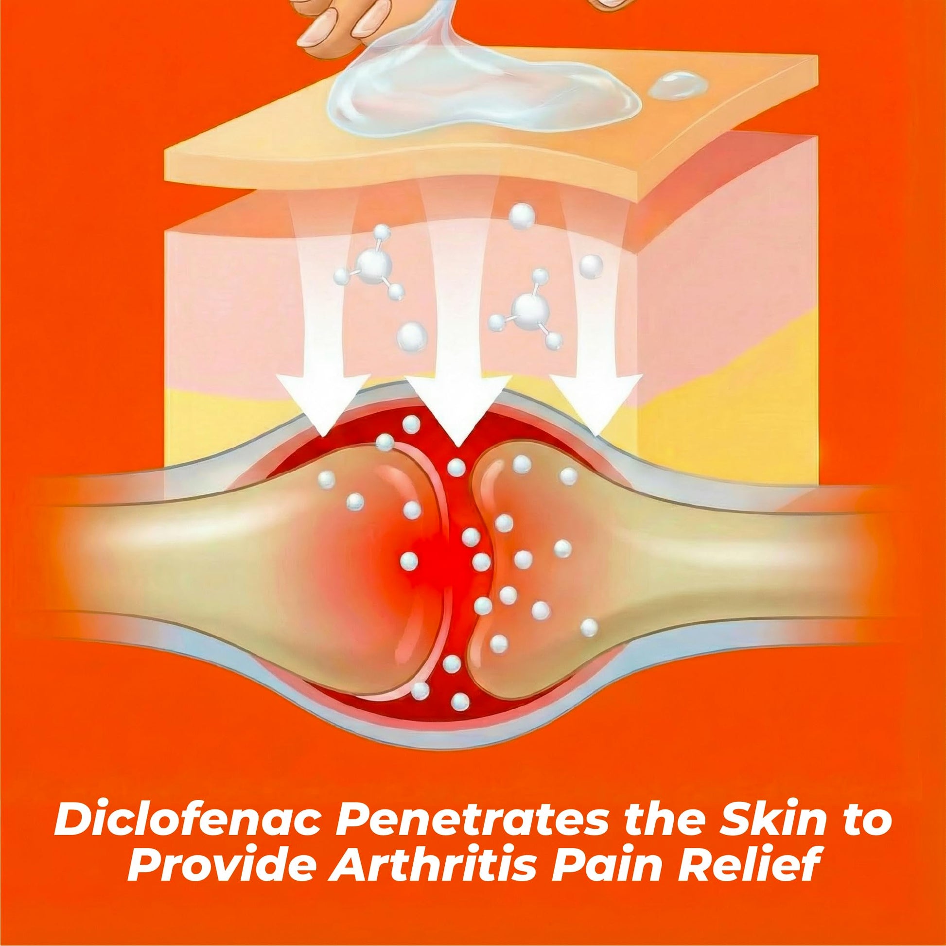 Aspercreme Arthritis Pain Relief Gel for Arthritis & Joint Pain, Non-steroidal Anti-inflammatory Topical Gel with Max-Strength Diclofenac Sodium, 50 g AspercremeBuy Supplements Australia