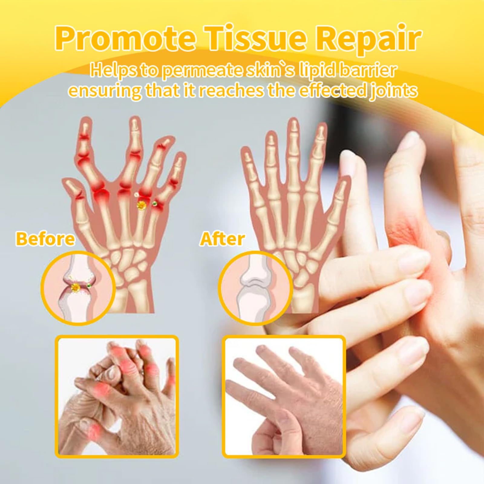 Luhaka Botulinum Toxin & Bee Venom Pain-Relief Bone Healing Cream,Bee Venom Cream,Effectively improve joint mobility (1PC) LuhakaBuy Supplements Australia