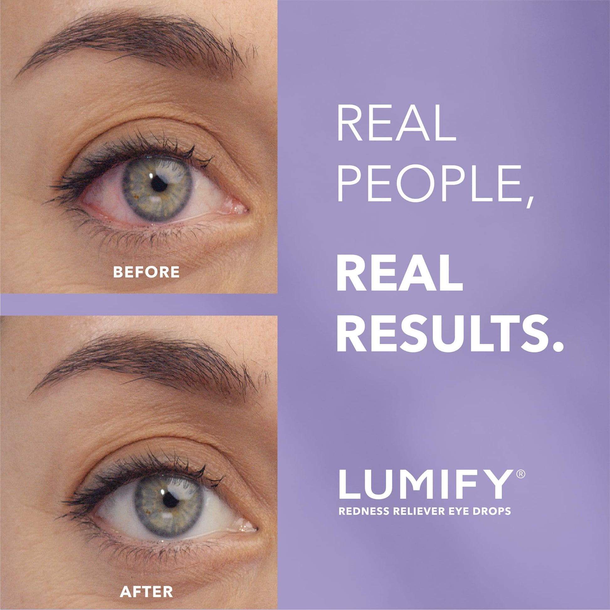 LUMIFY Eye Drops for Red Eyes, Redness Reliever for Brighter Looking Eyes, Works in 1 Minute & Lasts Up to 8 Hours, Eye Drops, 0.17 Fl Oz (5 mL) LUMIFY buy supplements Au