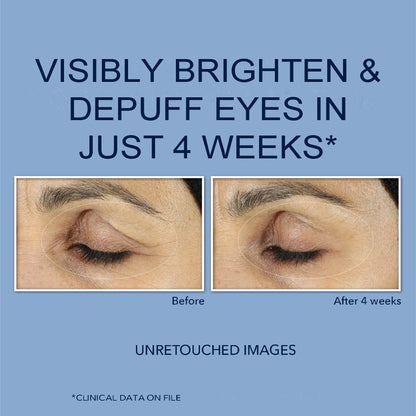 RoC Retinol Correxion Under Eye Cream for Dark Circles & Puffiness, Daily Wrinkle RoCBuy Supplements Australia