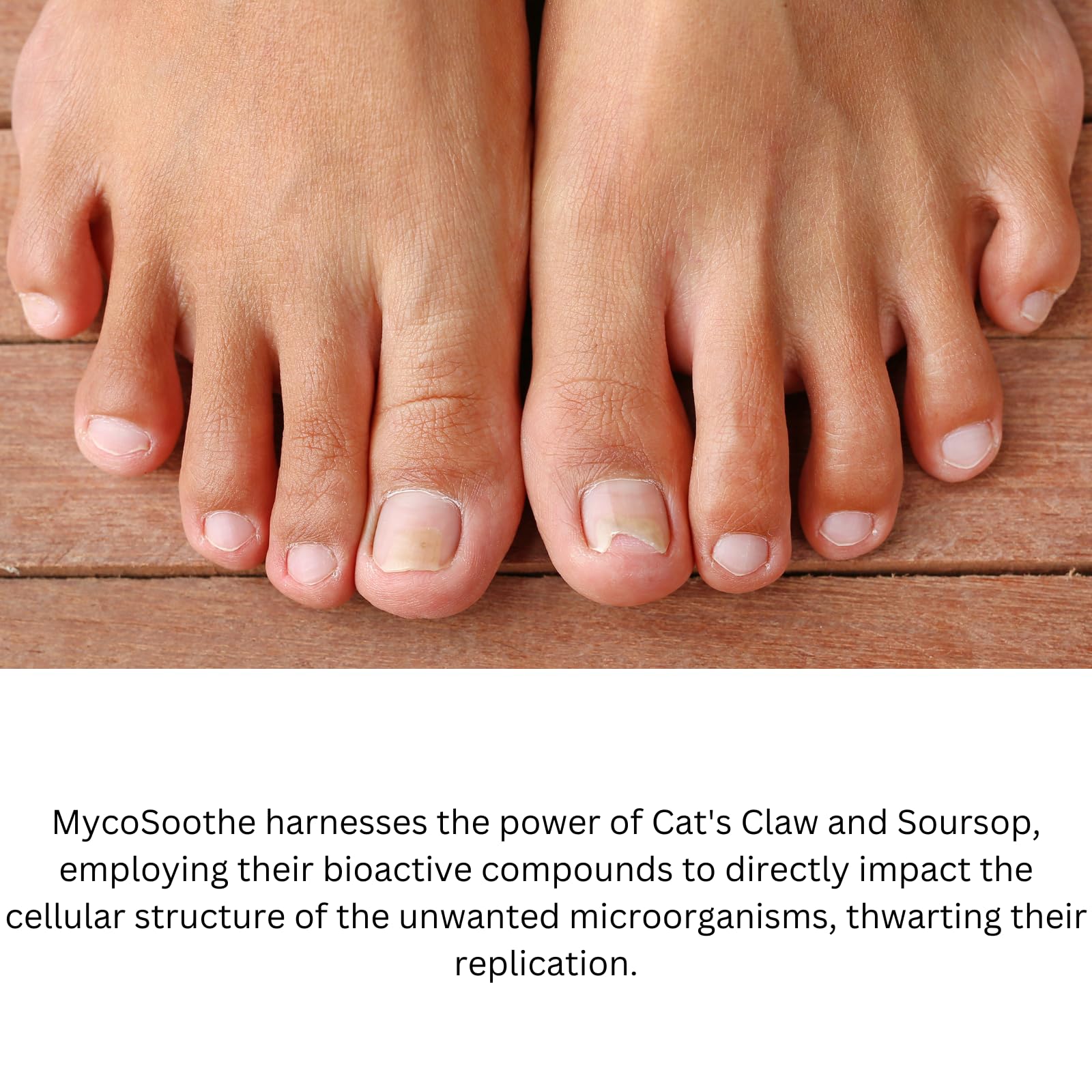 Phytage Labs MycoSoothe Advanced Hair, Skin, Nail & Immunity Support Formula - 60 Capsules Phytage LabsBuy Supplements Australia