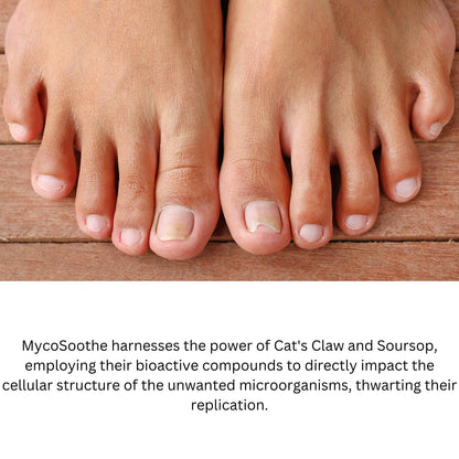 Phytage Labs MycoSoothe Advanced Hair, Skin, Nail & Immunity Support Formula - 60 Capsules Phytage LabsBuy Supplements Australia