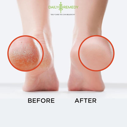 Muscle Relief Foot Soak with Epsom Salt, Made in USA, Soothe Foot Aches, Muscle Pain DAILY REMEDYBuy Supplements Australia