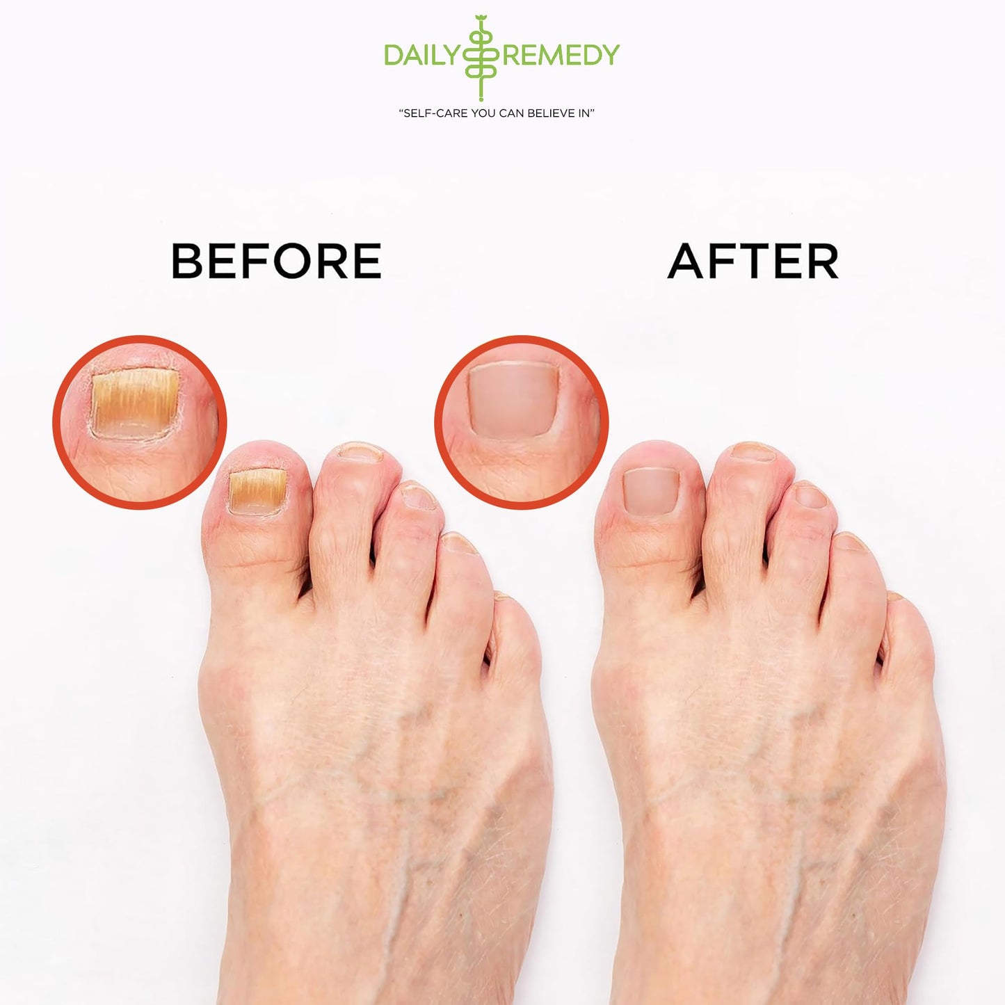 Muscle Relief Foot Soak with Epsom Salt, Made in USA, Soothe Foot Aches, Muscle Pain DAILY REMEDYBuy Supplements Australia