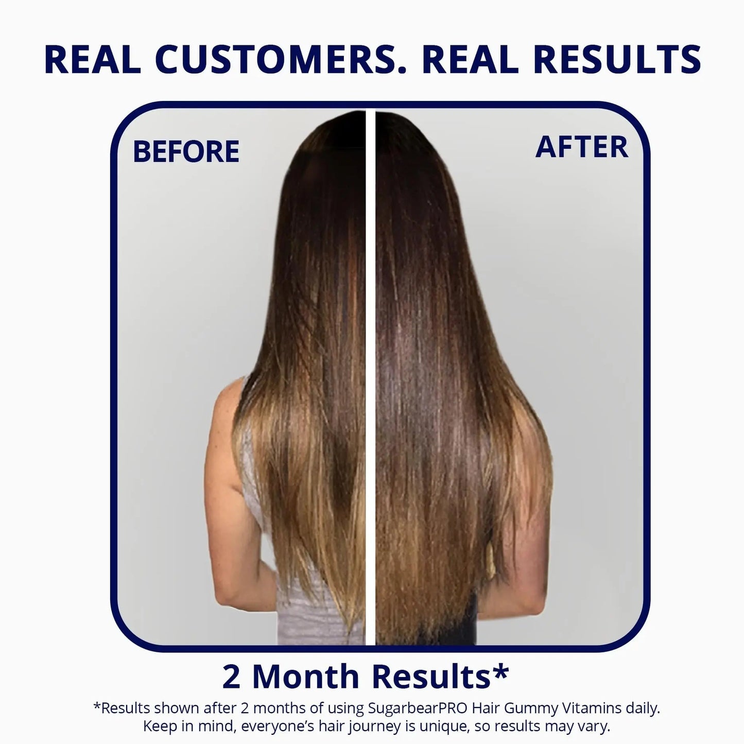 SugarBearPro Hair Vitamin Gummy 3 Month Supply Extra Strength Biotin 6000mcg, Growth for Men & Women, Vegan Vitamin B12 SugarBearHairBuy Supplements Australia