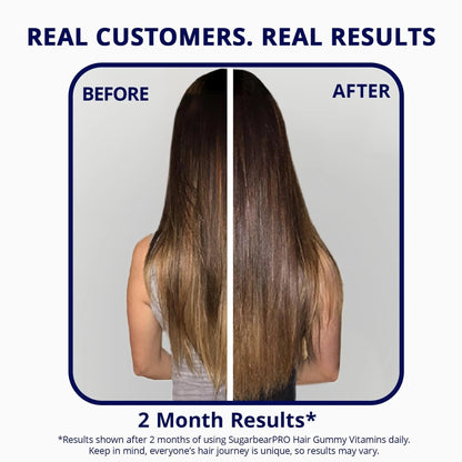 SugarBearPro Hair Vitamin Gummy 3 Month Supply Extra Strength Biotin 6000mcg, Growth for Men & Women, Vegan Vitamin B12 SugarBearHairBuy Supplements Australia
