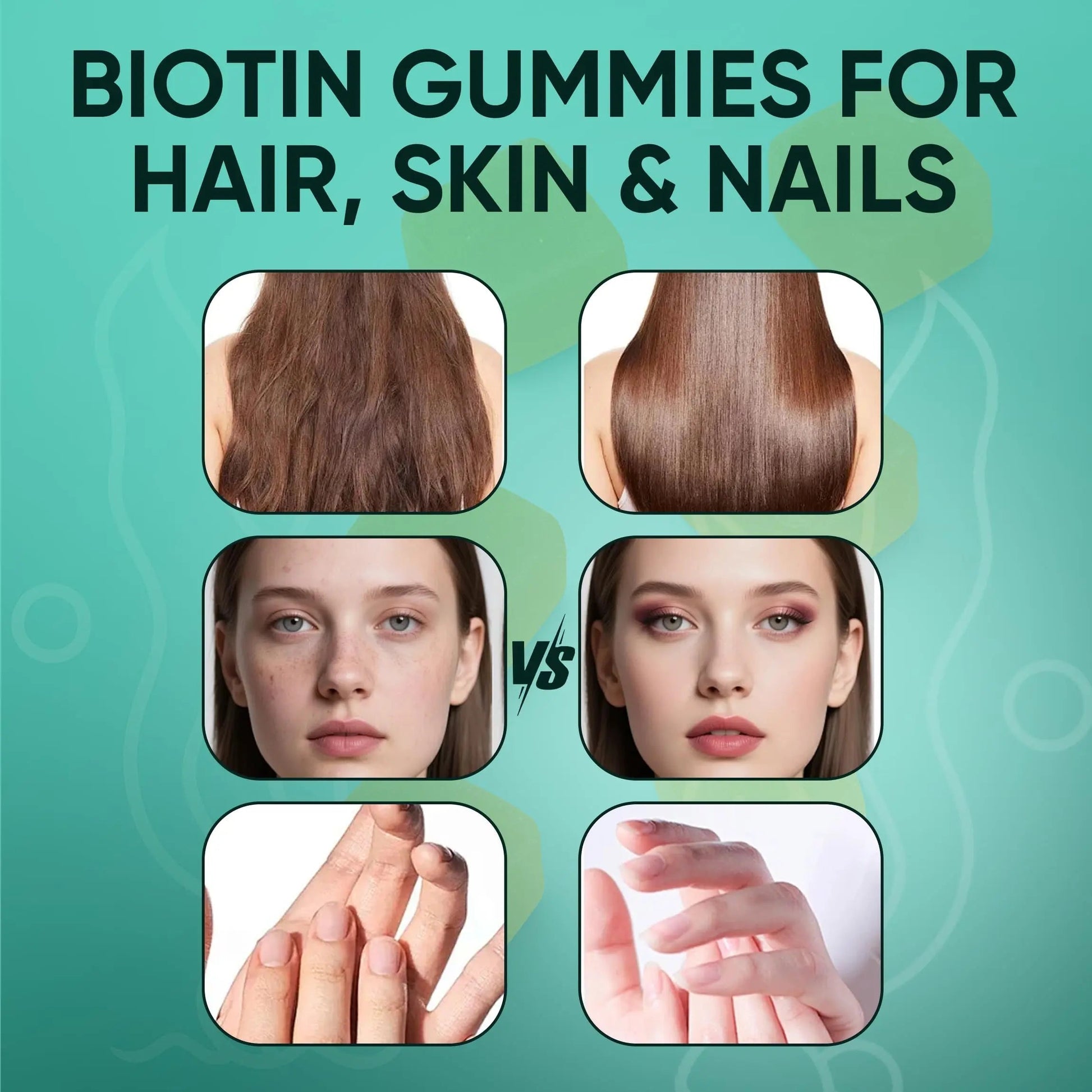 Neonomicon Balmbare Revive Gummies for Hair Loss - Sea Moss Gummies with Vitamin C, Vitamin E, Aloe Vera, Pearl Powder Supports Faster Hair Growth NeonomiconBuy Supplements Australia