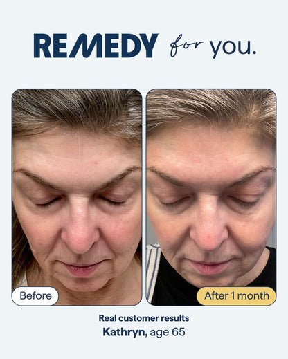 Remedy for Healthy Aging - Retinal, Resveratrol, Glycolic Acid, Argireline, Ferulic Acid, Matrixyl 3000 - Anti-Aging Treatment for Wrinkles, Uneven Texture & Tone - By Dermatologist Dr. Shah Remedy ScienceBuy Supplements Australia