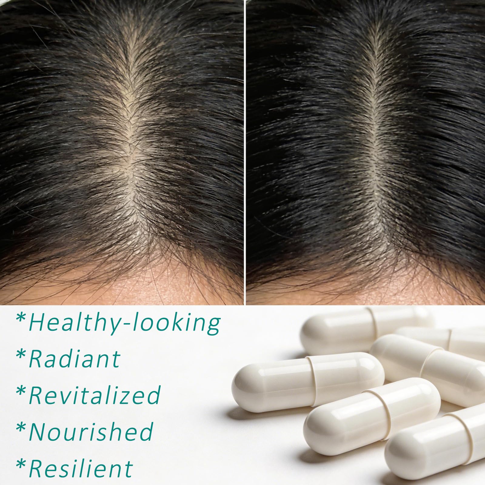 Hair Growth Biotin 10000mcg Supplement with Vitamins A C D E & Calcium - 30-in-1 Formula for Hair & Nails Support, for Women & Men, 30 Servings (1) WOJJBuy Supplements Australia
