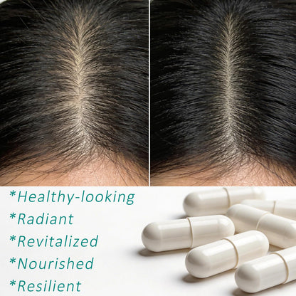 Hair Growth Biotin 10000mcg Supplement with Vitamins A C D E & Calcium - 30-in-1 Formula for Hair & Nails Support, for Women & Men, 30 Servings (1) WOJJBuy Supplements Australia