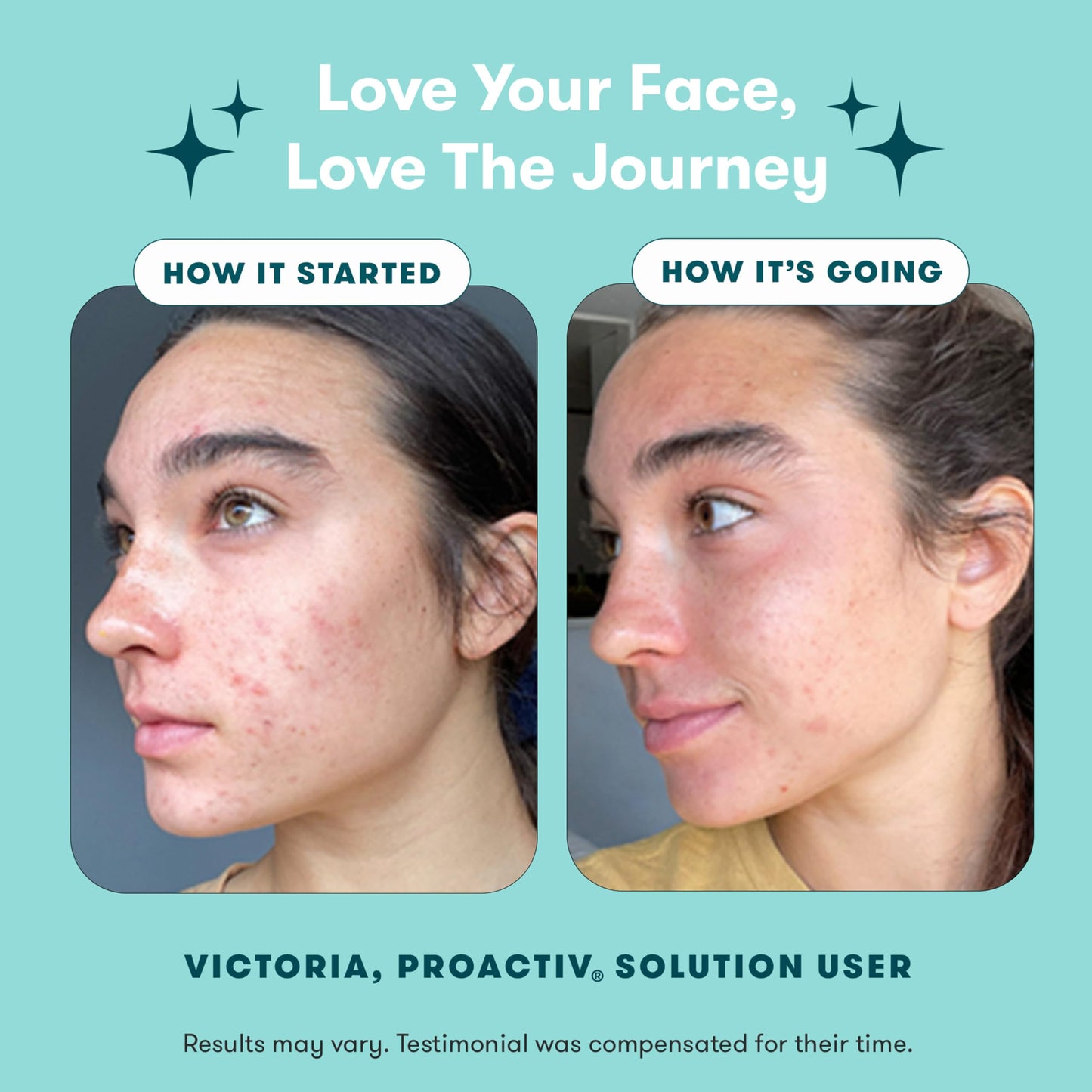 Proactiv 3 Step Acne Treatment - Benzoyl Peroxide Face Wash, Repairing Acne Spot Treatment for Face and Body