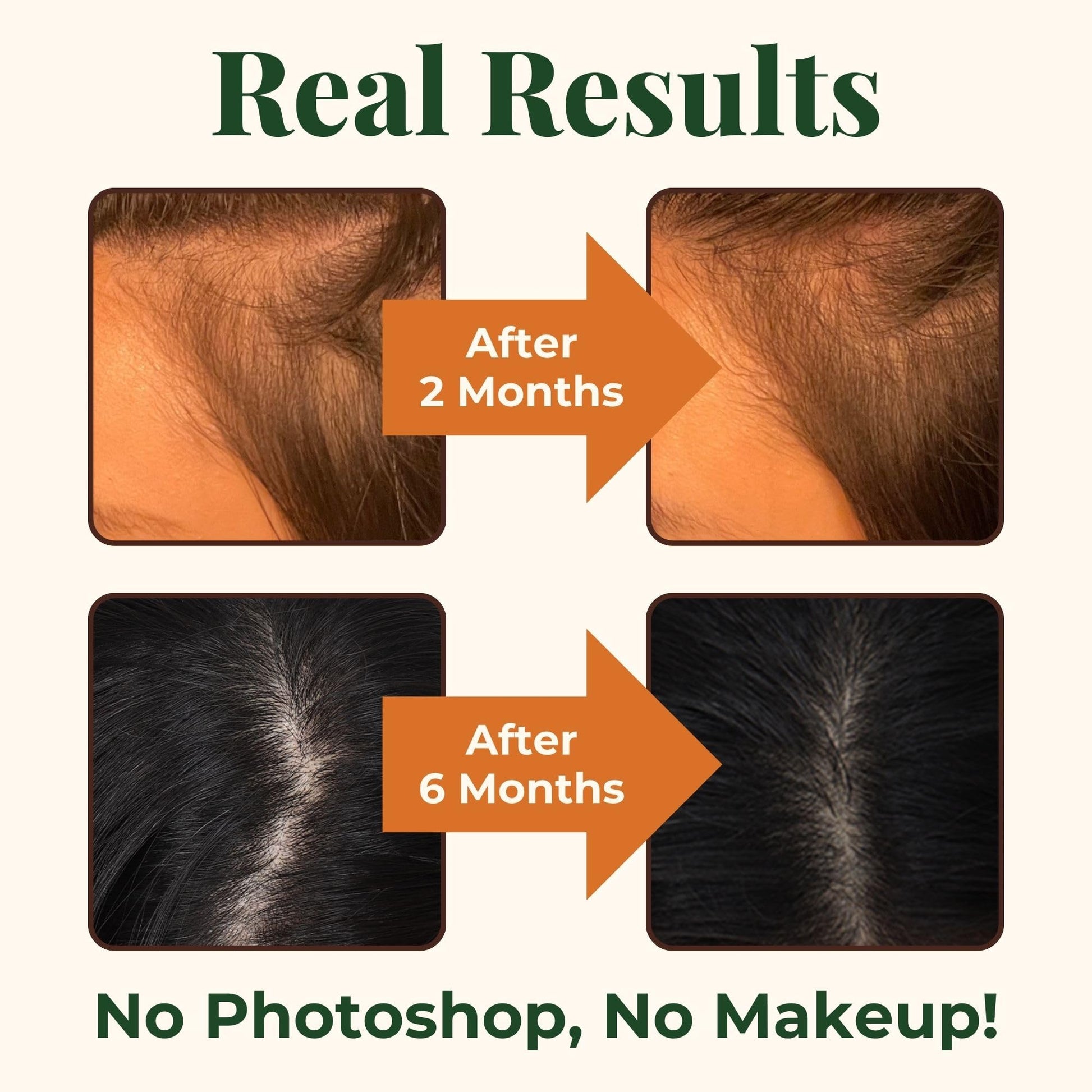 Heebin's Royal Hair, Brows & Lashes, Hair Growth Vitamins with Biotin 4000 mcg, Collagen Heebin'sBuy Supplements Australia