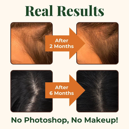 Heebin's Royal Hair, Brows & Lashes, Hair Growth Vitamins with Biotin 4000 mcg, Collagen Heebin'sBuy Supplements Australia