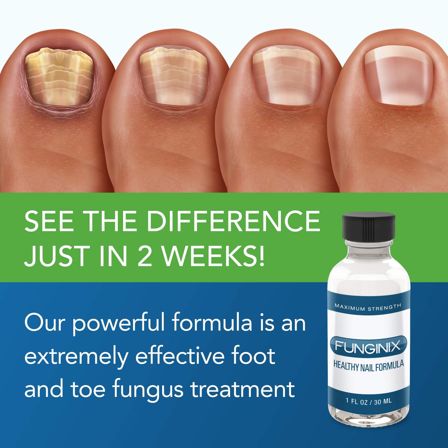 FUNGINIX Healthy Nail Formula - Finger And Toe Fungus Treatment, Made In USA, Foot FUNGINIXBuy Supplements Australia