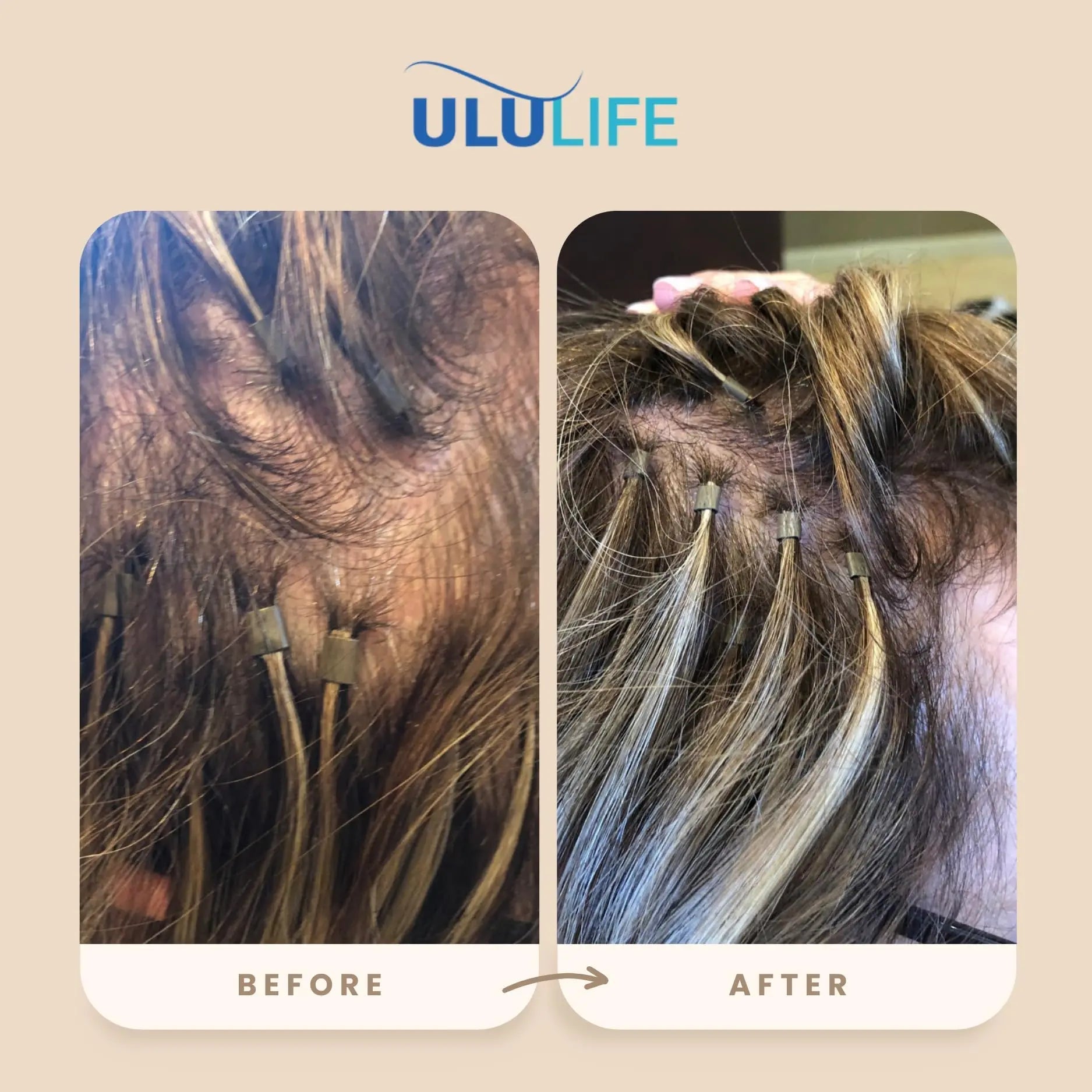 ULULIFE Complete Multivitamin for Men & Women: All-Natural & Cruelty Free with Biotin, Collagen, Keratin, & More - Promotes Hair Growth & Thickness ULULIFEBuy Supplements Australia