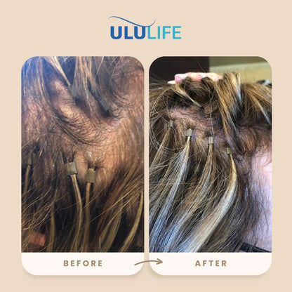 ULULIFE Complete Multivitamin for Men & Women: All-Natural & Cruelty Free with Biotin, Collagen, Keratin, & More - Promotes Hair Growth & Thickness ULULIFEBuy Supplements Australia