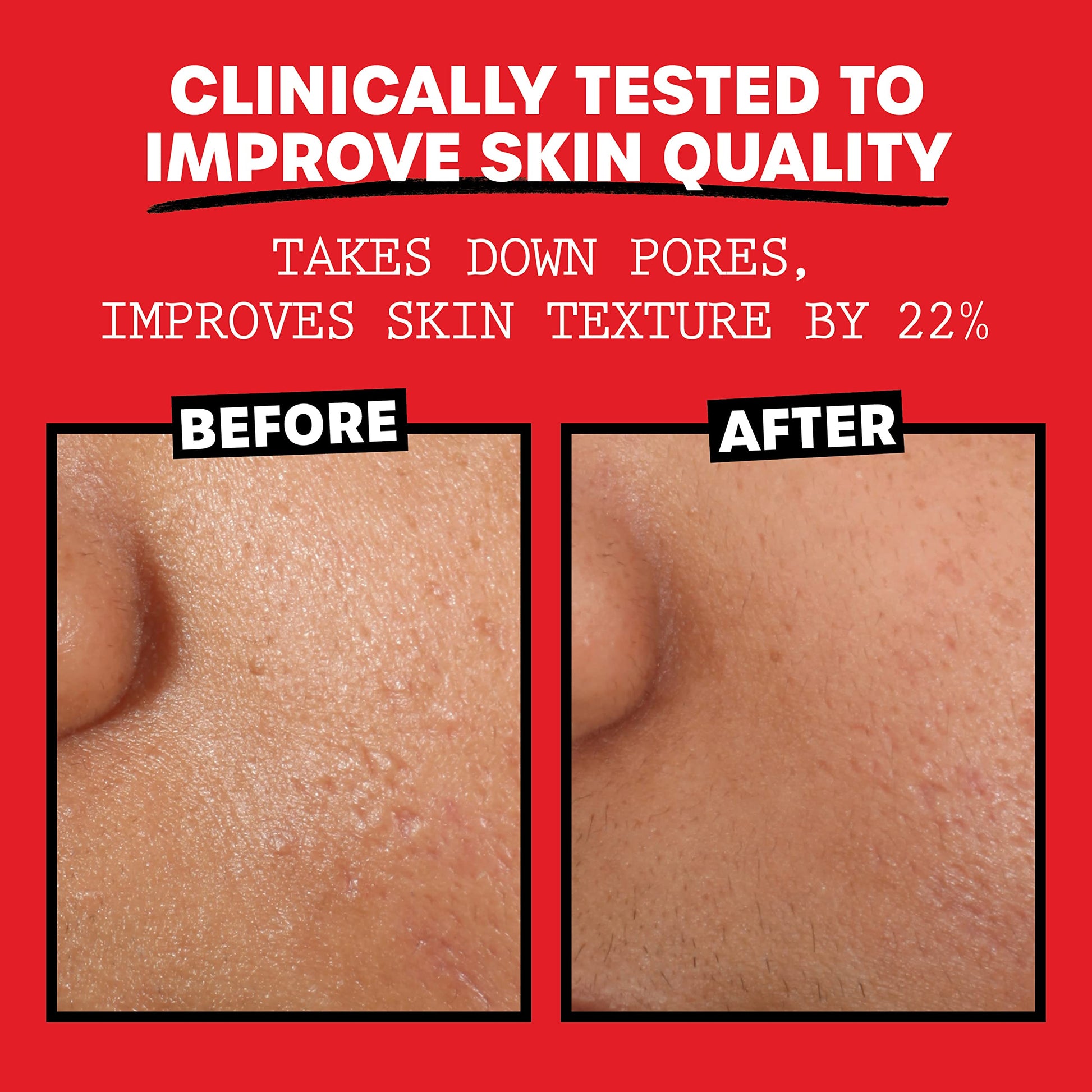 Thayers Alcohol-Free, Hydrating Rose Petal Witch Hazel Facial Toner 12 oz + 3oz THAYERSBuy Supplements Australia