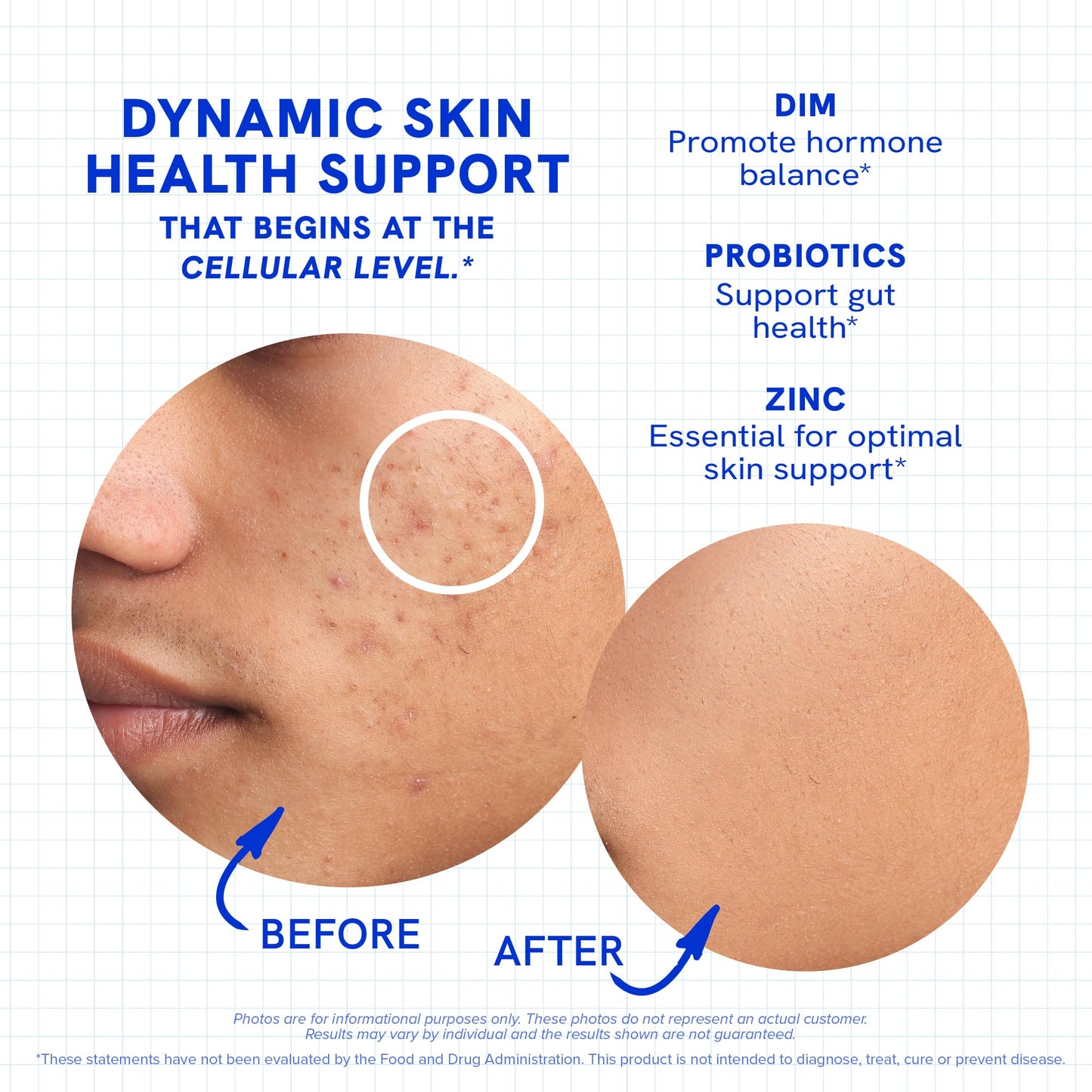 Clear Skin Supplement with Zinc, DIM & Probiotics | 3-in-1 Balance, Glow & Health Skin Support | Triple Action Hyaluronic Acid, Niaciminide & Vitamins for Hormone, Complexion & Gut Support | 180 Ct SMNutritionBuy Supplements Australia