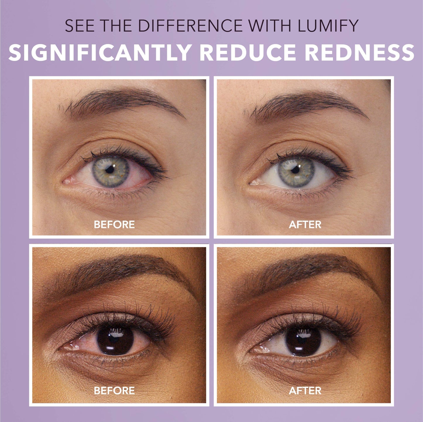 LUMIFY Eye Drops for Red Eyes, Redness Reliever for Brighter Looking Eyes, Works in 1 Minute & Lasts Up to 8 Hours, Eye Drops, 0.25 Fl Oz (7.5mL) LUMIFY buy supplements Au