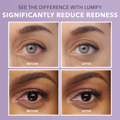 LUMIFY Eye Drops for Red Eyes, Redness Reliever for Brighter Looking Eyes, Works in 1 Minute & Lasts Up to 8 Hours, Eye Drops, 0.25 Fl Oz (7.5mL) LUMIFY buy supplements Au