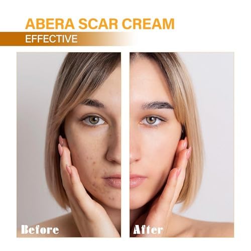 ABERA Scar Removal Cream for Women and Men - Rapid Repair of New Old Scars, Spots, Burns All Natural Treatment with Vitamin E, Alanine, Collagen (1 Box + 3 Eye Patch) - Maple Wellness Supplements