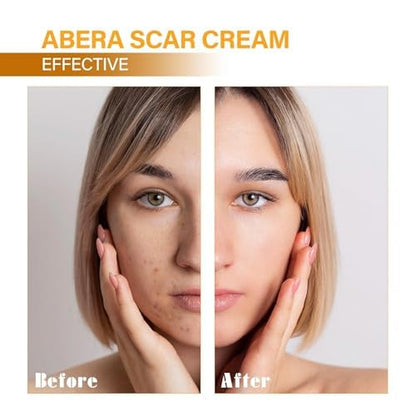 ABERA Scar Removal Cream for Women and Men - Rapid Repair of New Old Scars, Spots, Burns All Natural Treatment with Vitamin E, Alanine, Collagen (1 Box + 3 Eye Patch) - Maple Wellness Supplements