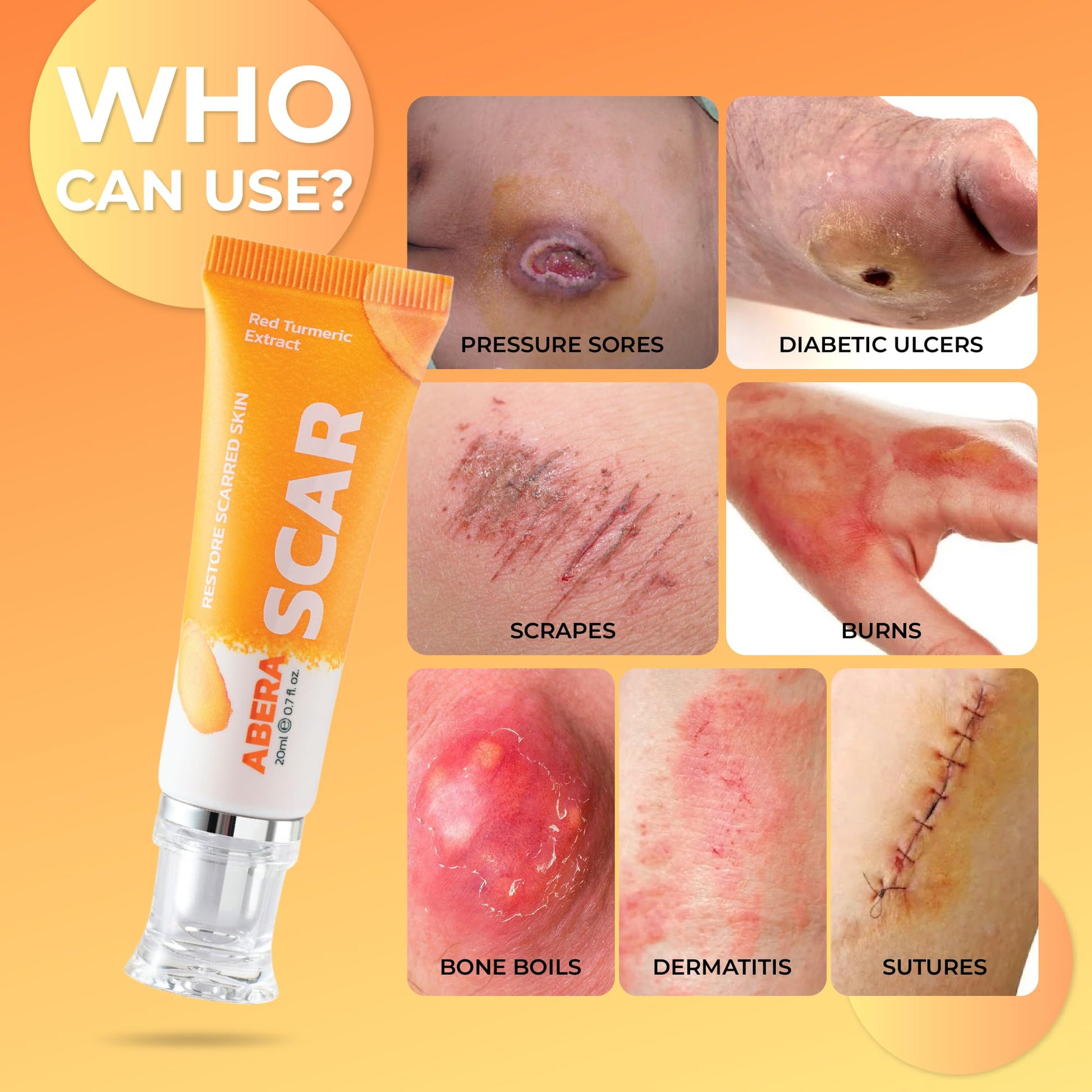 ABERA Scar Removal Cream for Women and Men - Rapid Repair of New Old Scars, Spots, Burns All Natural Treatment with Vitamin E, Alanine, Collagen (1 Box + 3 Eye Patch) - Maple Wellness Supplements