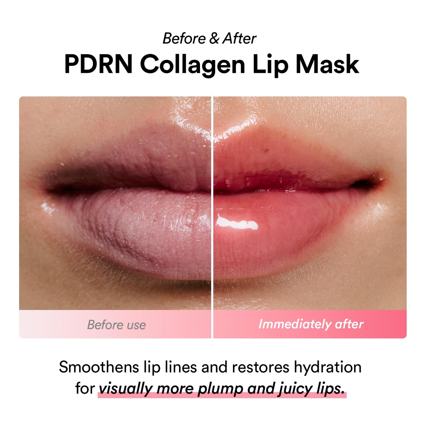 Abib PDRN Collagen Lip Mask Glazed Jelly 0.38 fl oz | Korean Lip Butter Balm Overnight Sleeping Mask Hydrating Care Moisturizer Treatment for Flakey, Dry Lips - Maple Wellness Supplements