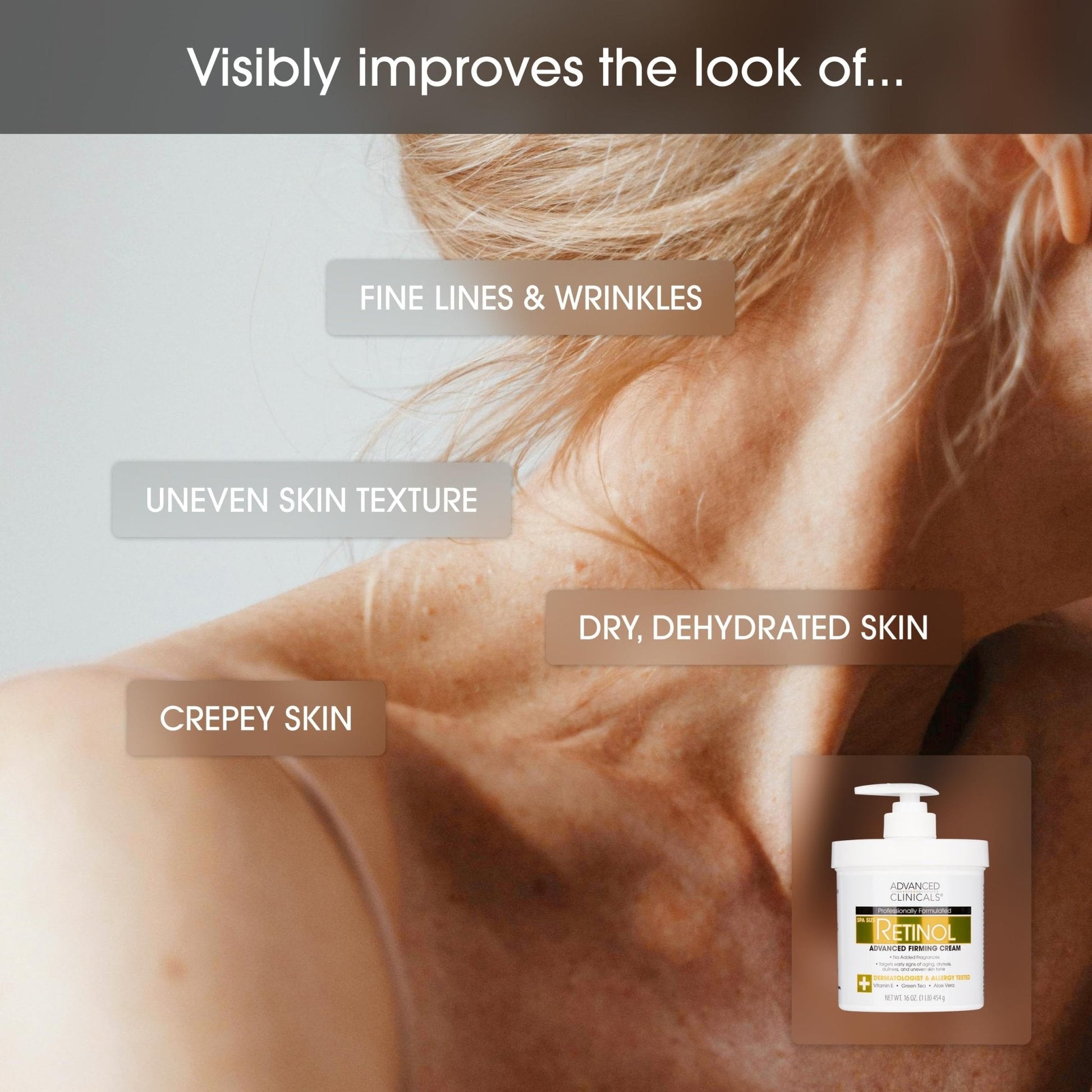 Advanced Clinicals Retinol Body Lotion & Face Moisturizer | Visible Anti Aging Skin Care Retinol Body Cream For Women & Men Targets Look Of Fine Lines - Maple Wellness Supplements