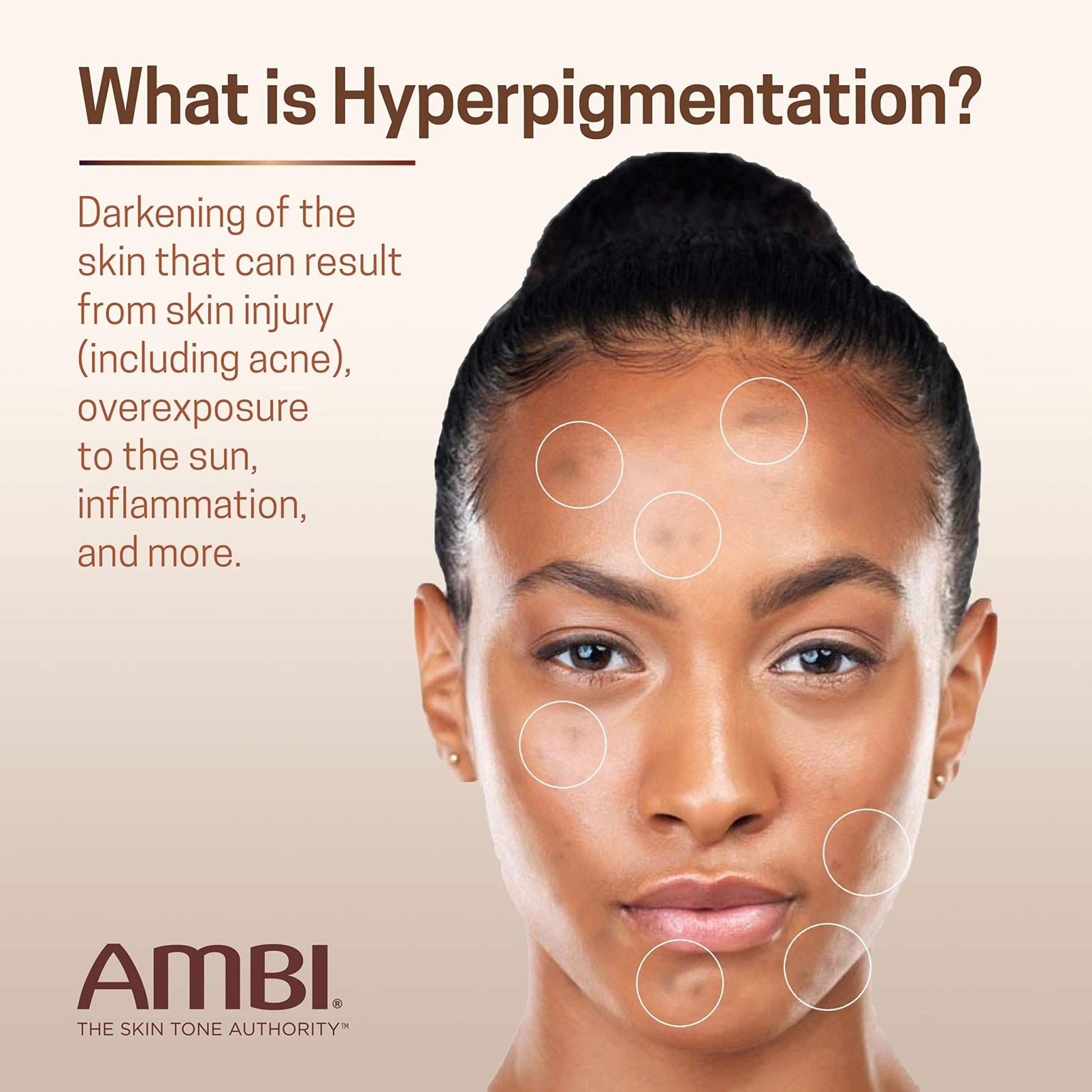 Ambi Even & Clear Advanced Fade Cream, Hydroquinone-free, Hyperpigmentation Treatment, Stubborn Dark Spot Corrector, Results In As Little As 2-3 Weeks - Maple Wellness Supplements