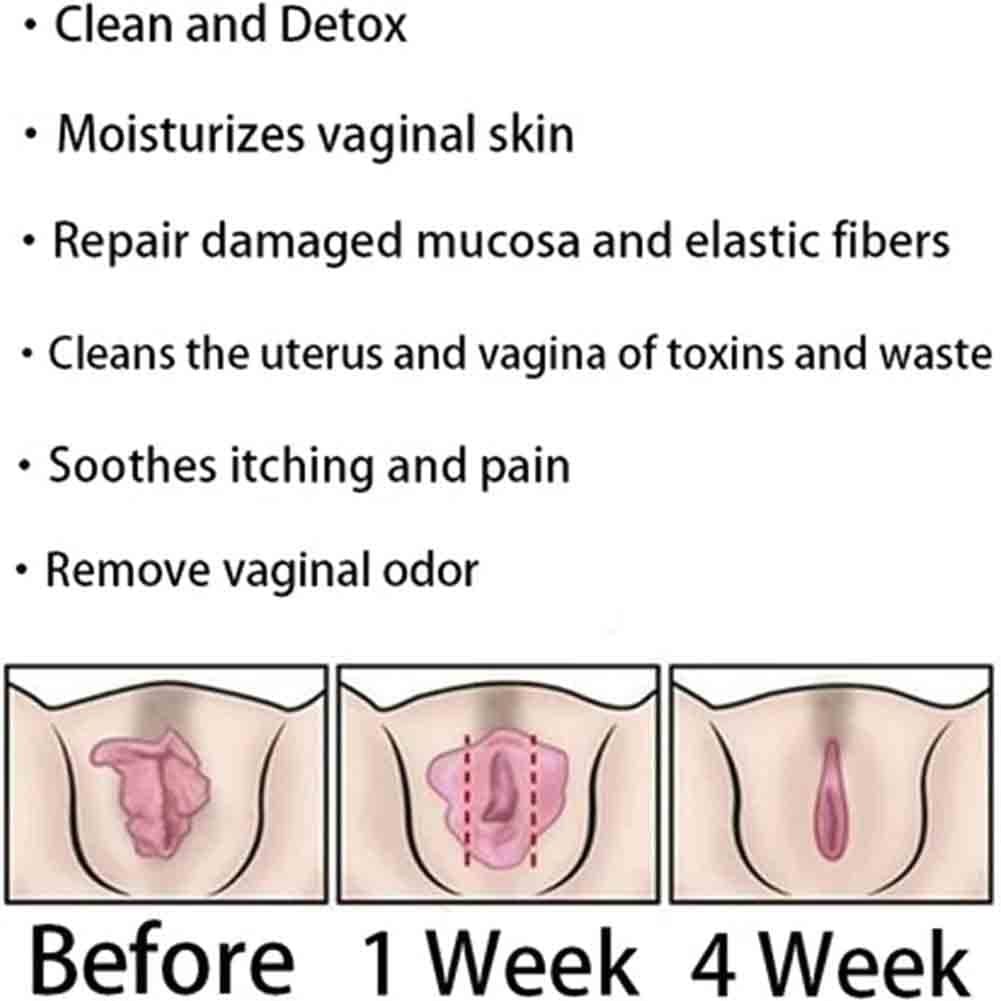 AnnieCare Instant Anti-Itch Detox Products, Annie Care Capsulas, Firming Repair & Pink - Maple Wellness Supplements