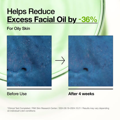Anua Azelaic Acid 10 Hyaluron Redness Soothing Serum, Facial Serum for Blemish-Prone & Oily-Prone Skin - Maple Wellness Supplements