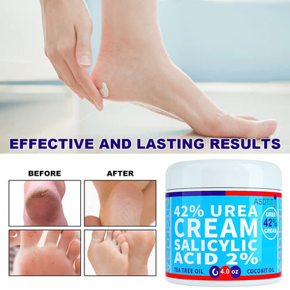 ASDToTio Urea Cream 42% - Premium Urea Foot Cream - With 2% Salicylic Acid, Tea Tree Oil, Shea Butter, Aloe Vera - For Feet, Hands, Heels, Elbows, Knees and More - 4 oz - Maple Wellness Supplements