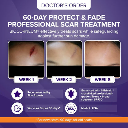 Biocorneum Advanced Scar Treatment with Silishield® & SPF 30 10g – Medical Grade Silicone Gel to Support Healing of Surgical Scars and Marks - Maple Wellness Supplements