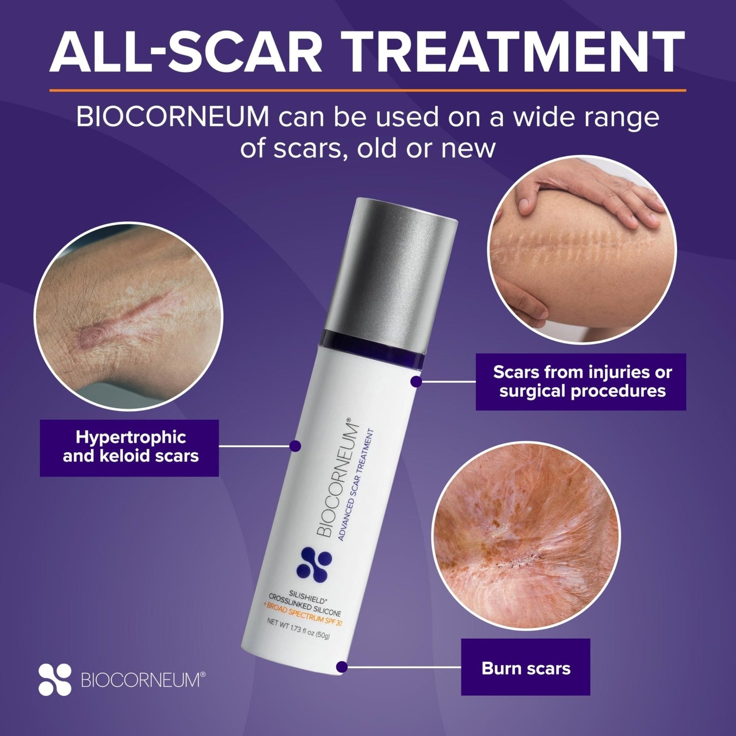 Biocorneum Advanced Scar Treatment with Silishield® & SPF 30 10g – Medical Grade Silicone Gel to Support Healing of Surgical Scars and Marks - Maple Wellness Supplements
