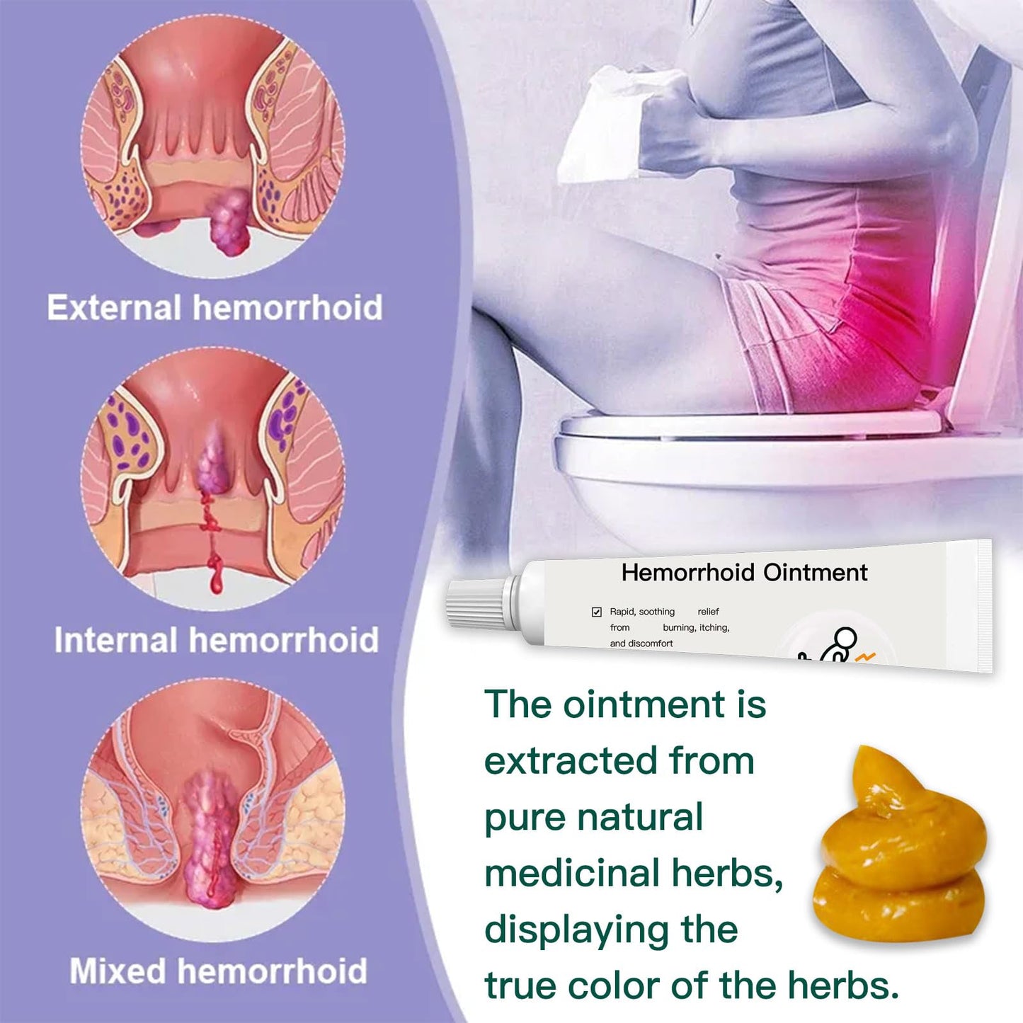 BXQJRJ Hemorrhoid Ointment,Herbal hemorrhoid Gel,Effectively relieves Anal discomfort,Suitable for Men and Women,Fast-Acting hemorrhoid Ointment (20g) - Maple Wellness Supplements