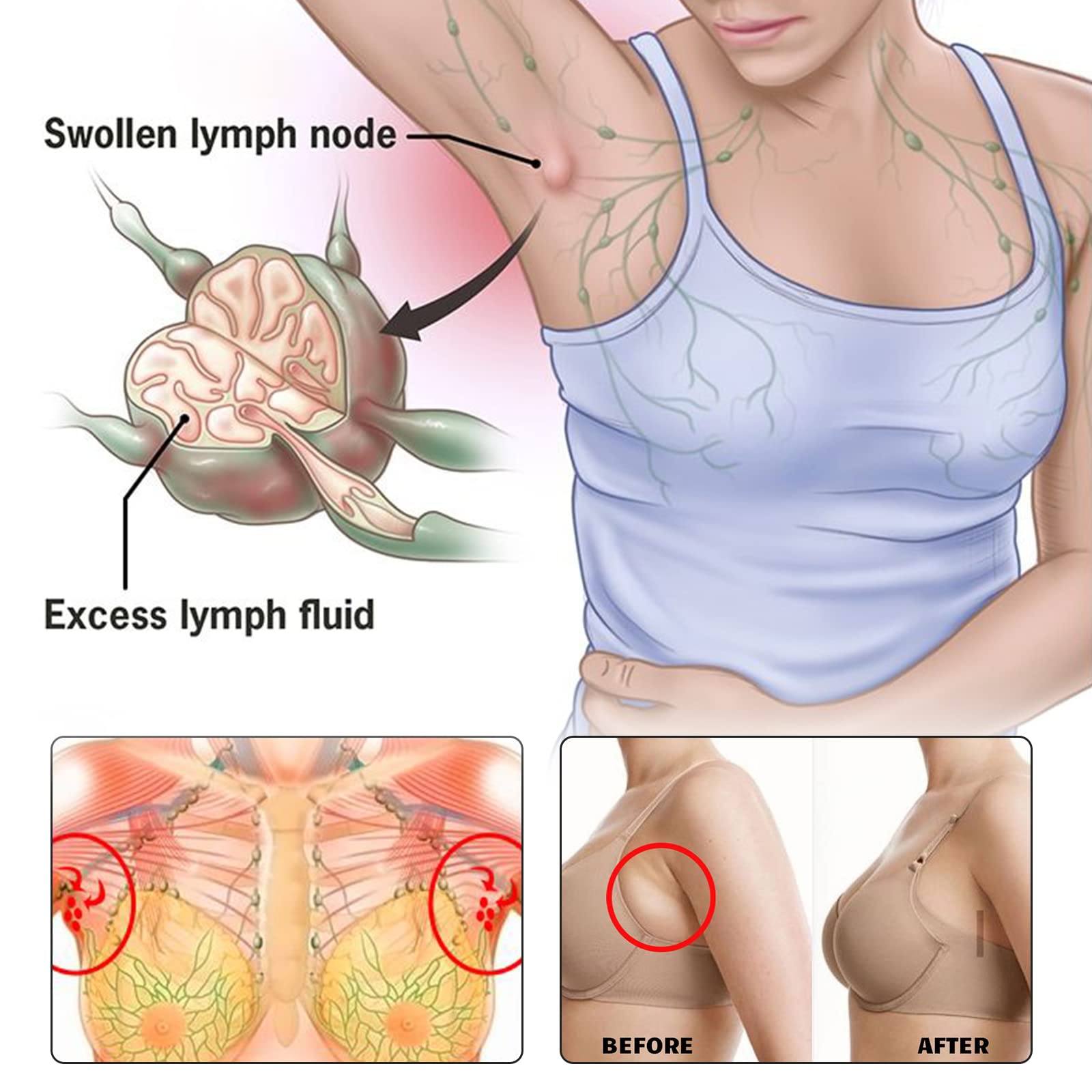BXQJRJLymphatic Drainage Patch Lymphatic Drainage Herbal Lymphatic Drainage Care Patch Herbal Neck Patch (12) - Maple Wellness Supplements