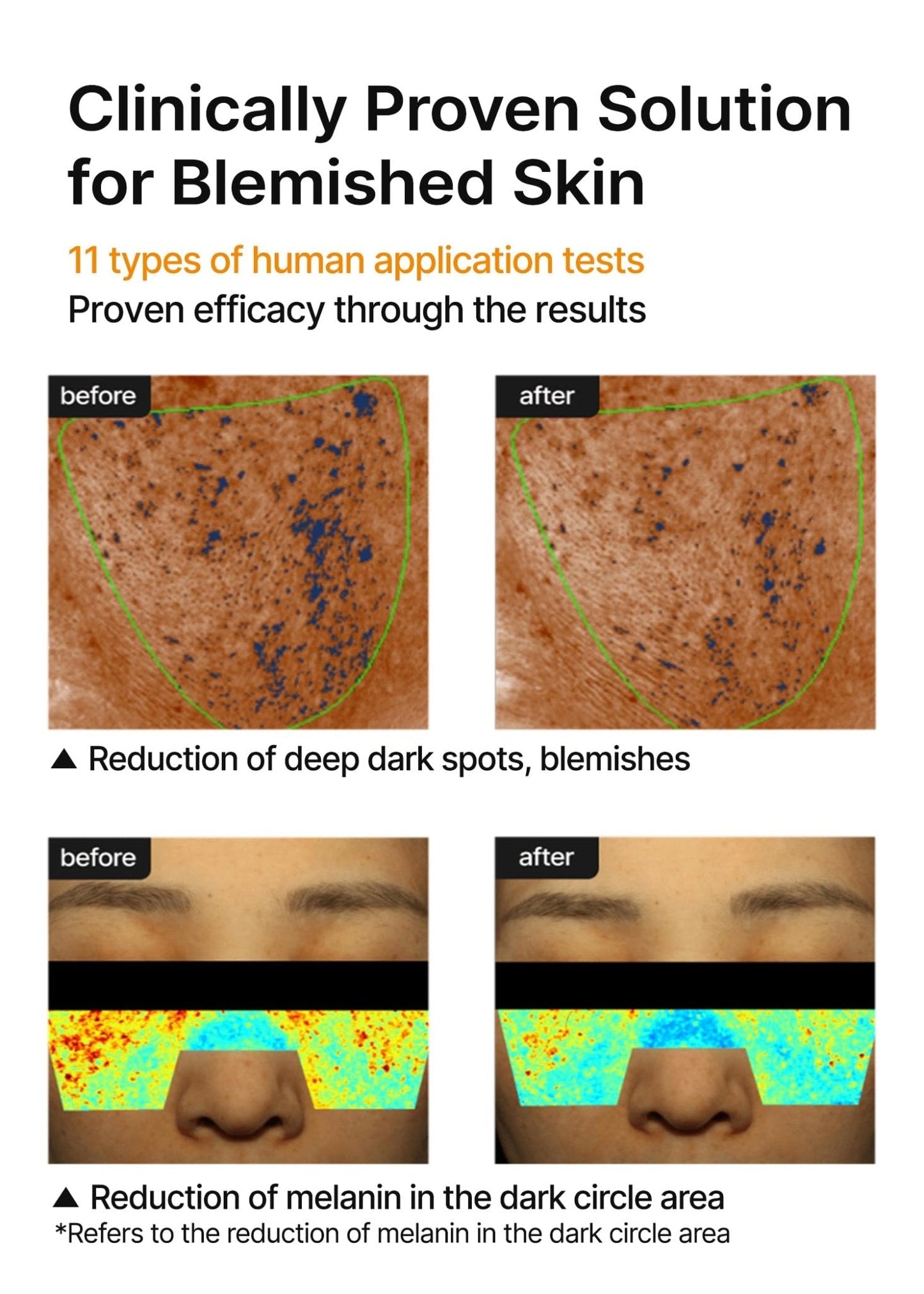 celimax Pore+Dark Spot Brightening Cream | with Niacinamide, Tranexamic Acid, TXA Cream - Maple Wellness Supplements