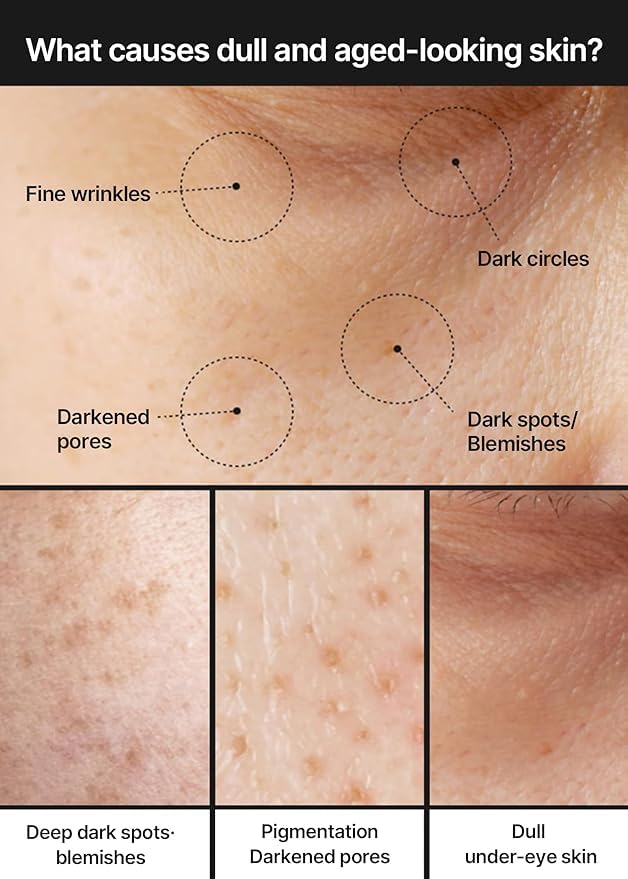 celimax Pore+Dark Spot Brightening Cream | with Niacinamide, Tranexamic Acid, TXA Cream - Maple Wellness Supplements