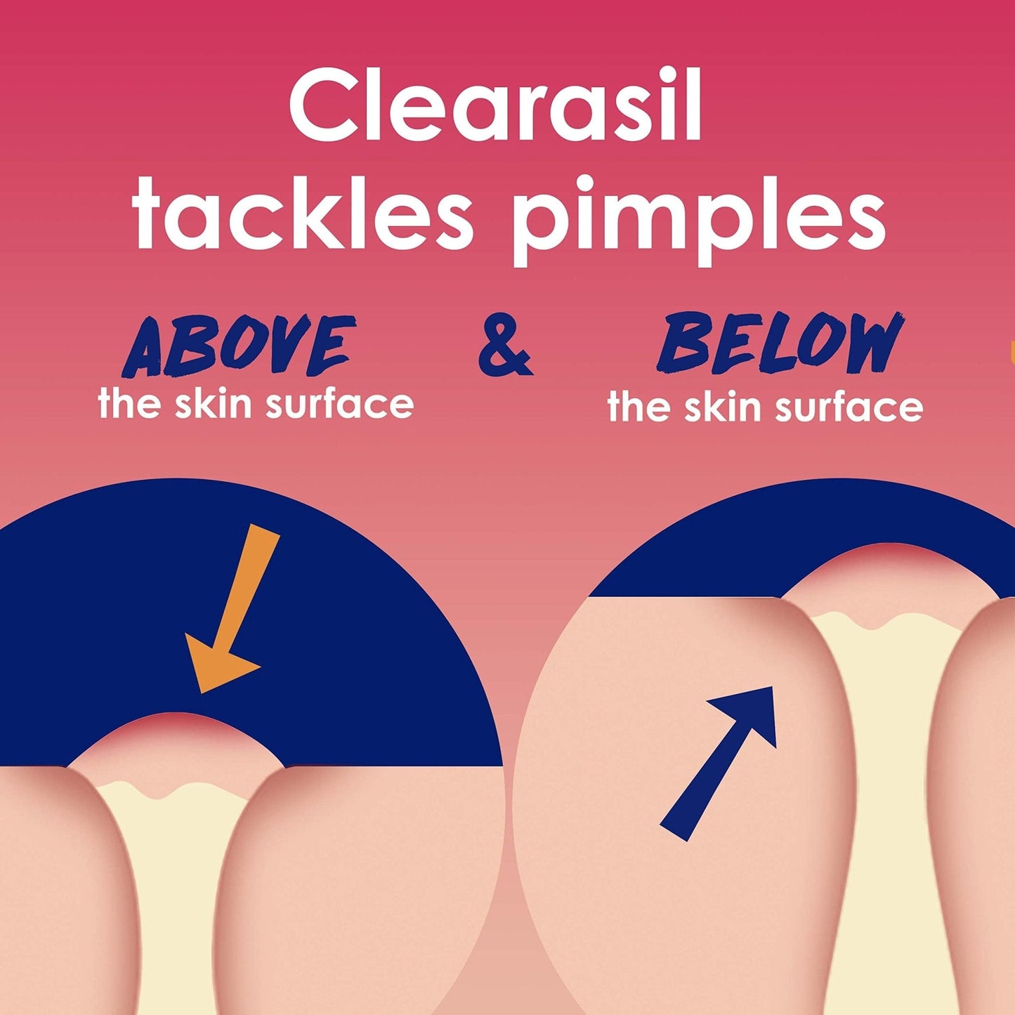 Clearasil Rapid Rescue Deep Treatment Acne Face Pads, Maximum Strenght with 2% Salicylic Acid Acne - Maple Wellness Supplements