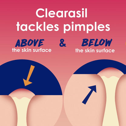 Clearasil Rapid Rescue Deep Treatment Acne Face Pads, Maximum Strenght with 2% Salicylic Acid Acne - Maple Wellness Supplements