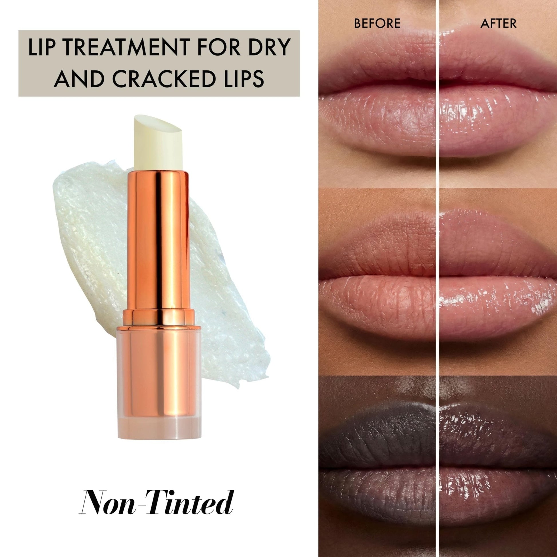 Clinexil Lip Balm – Hydrating Lip Repair with Cold-Pressed Oils, 10% Squalane, Vitamin E & Ceramides - Maple Wellness Supplements
