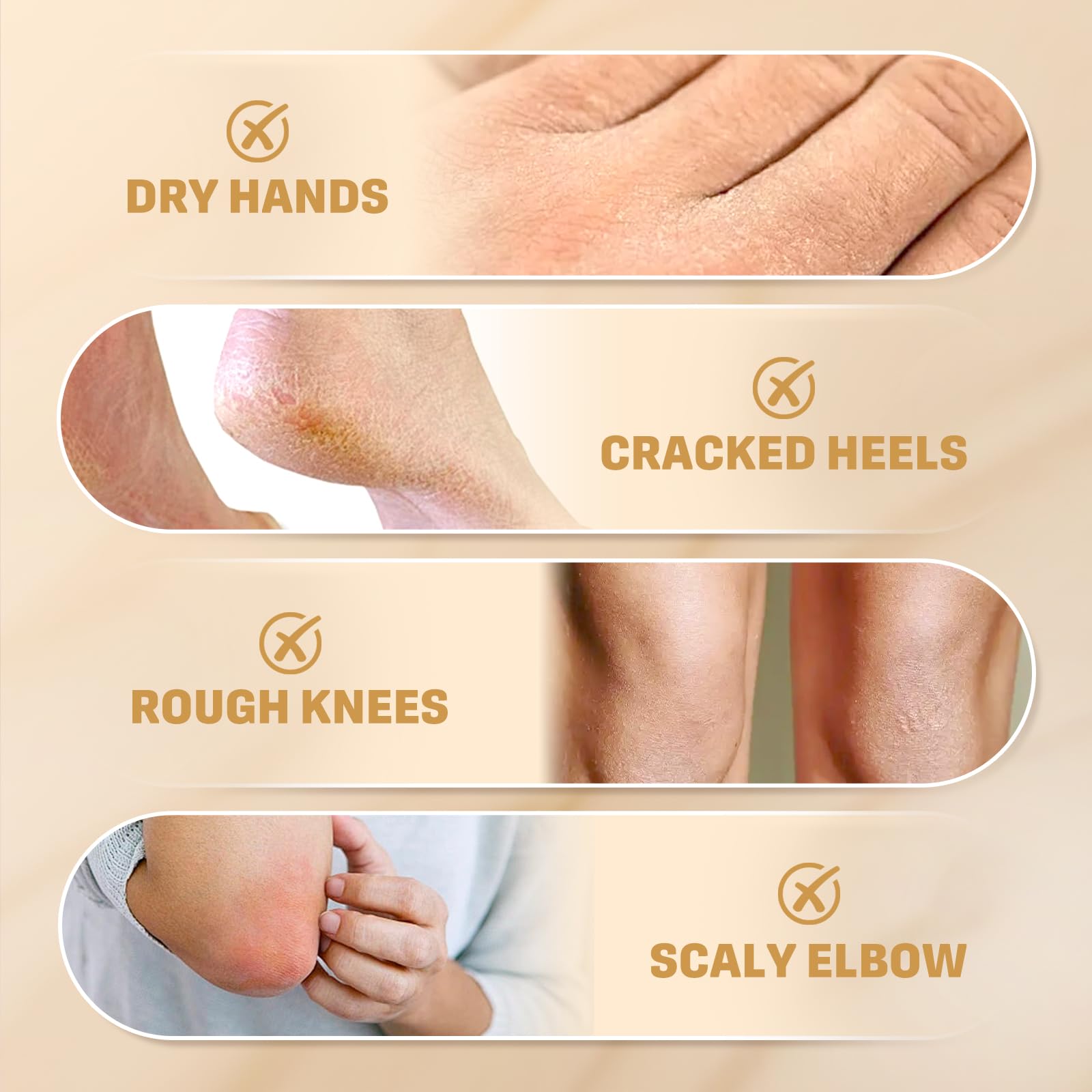 Clyecfra 60% Urea Cream with 2% Salicylic Acid, Urea Cream 60 Percent for Feet & Hands- Maximum Strength Moisturizer for Rough, Dry, Thick & Cracked Skin, Callus Remover, Deep Hydration, 150g - Maple Wellness Supplements