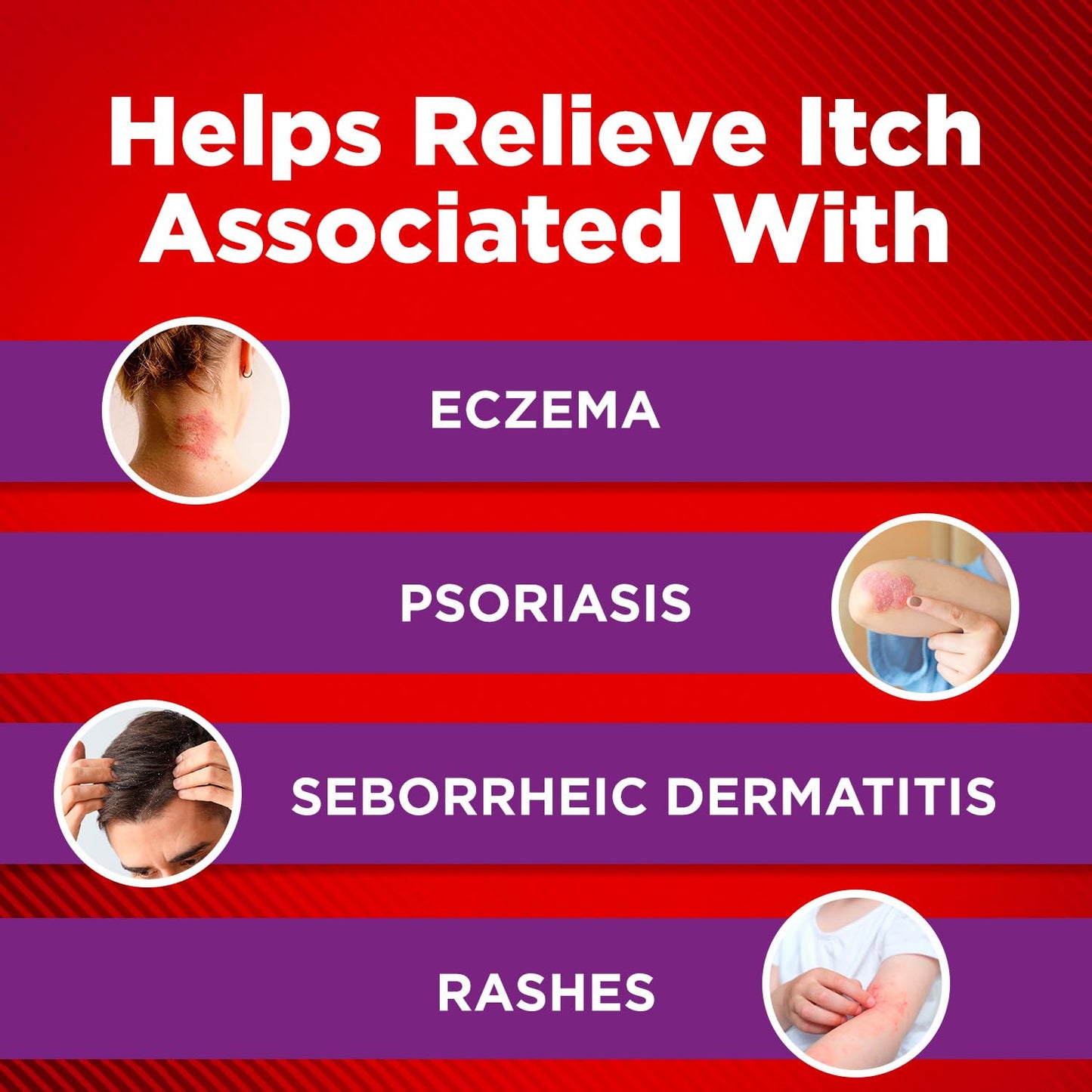 Cortizone-10 Maximum Strength Intensive Healing Itch Relief Lotion for Eczema, 1% Hydrocortisone, Fast-Acting, Anti-Itch Cream for Minor Skin Irritations, Rashes and Inflammation Due to Eczema, 3.5 oz - Maple Wellness Supplements