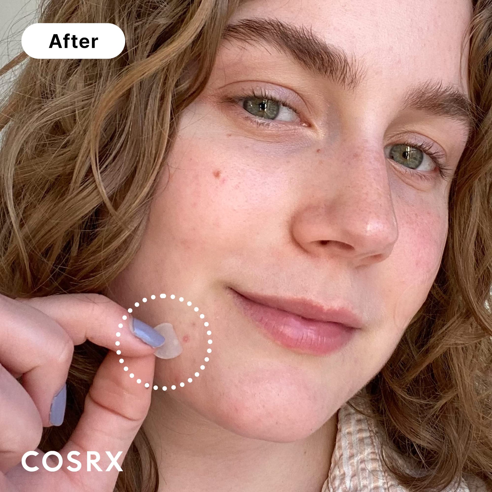 COSRX Acne Pimple Patch (96) Absorbing Hydrocolloid Original 3 Size Patches for Blemishes and Zits Cover - Maple Wellness Supplements