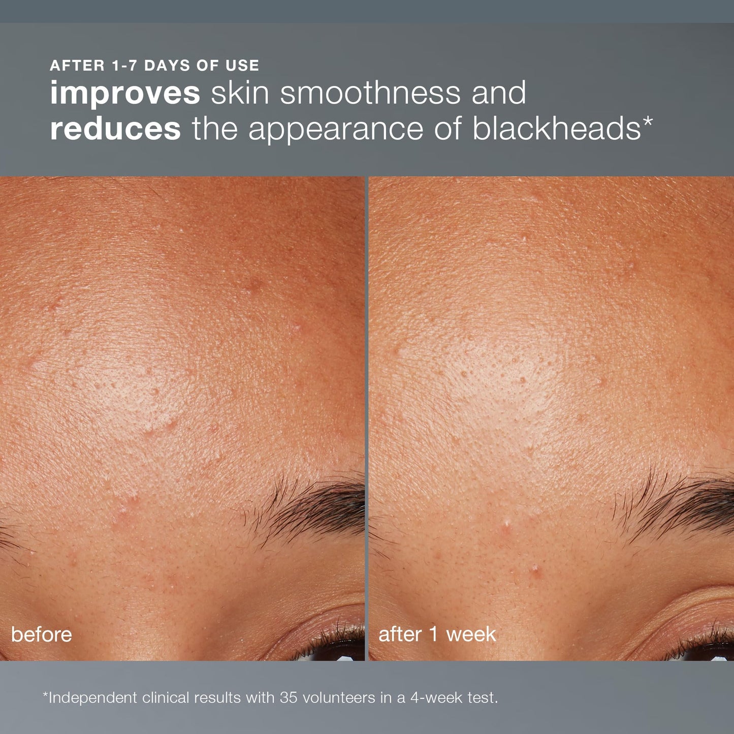 Dermalogica Daily Microfoliant, Face Exfoliator Scrub Powder with Salicylic Acid and Papaya - Maple Wellness Supplements