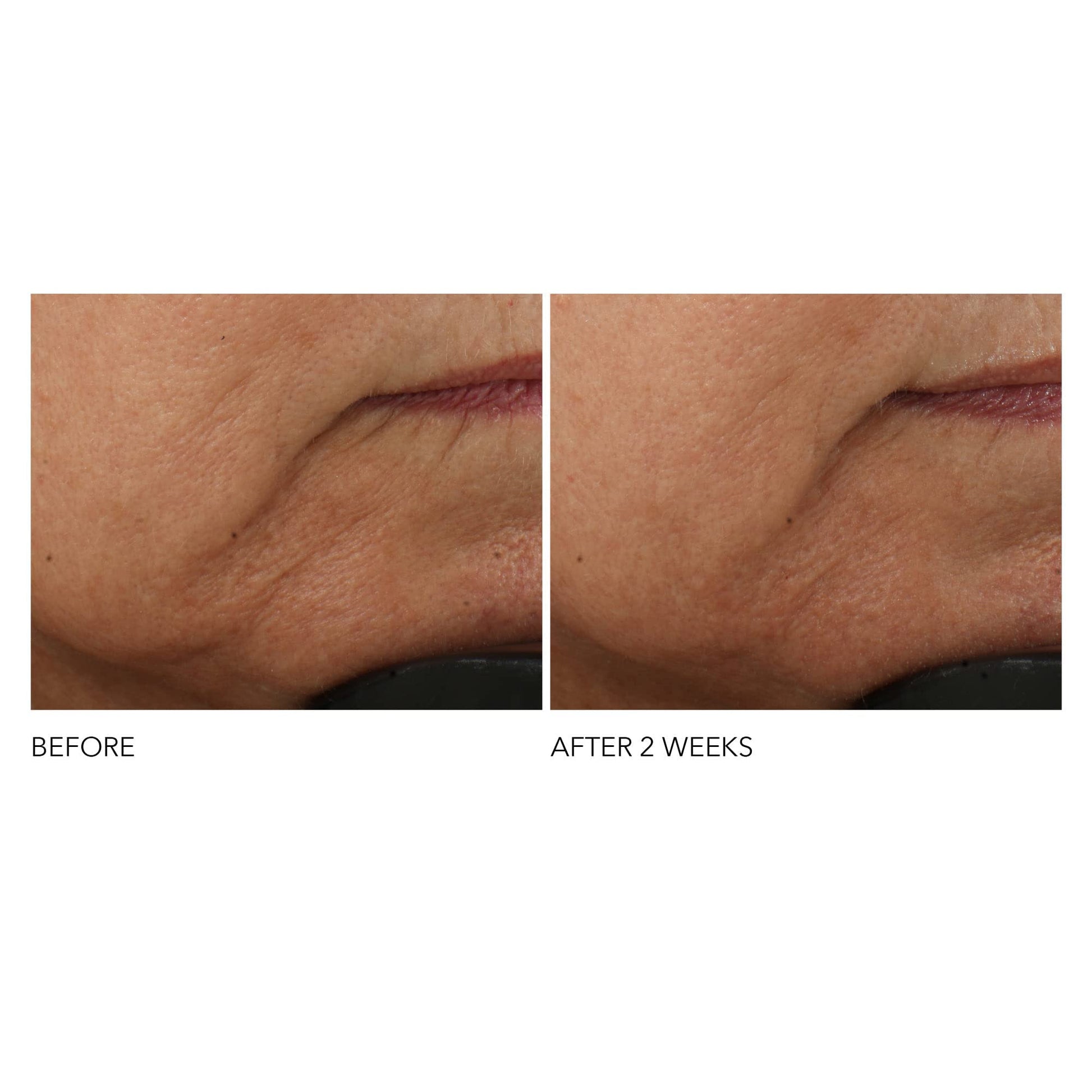 Dr Dennis Gross Advanced Retinol + Ferulic Intense Wrinkle Cream | Intensely Hydrating to Visibly Transform Skin and Repair the Moisture Barrier | 2 oz - Maple Wellness Supplements