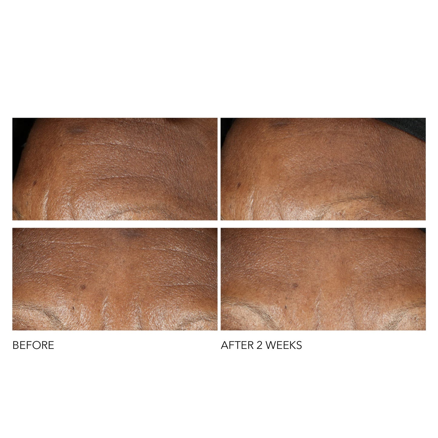 Dr Dennis Gross Advanced Retinol + Ferulic Intense Wrinkle Cream | Intensely Hydrating to Visibly Transform Skin and Repair the Moisture Barrier | 2 oz - Maple Wellness Supplements
